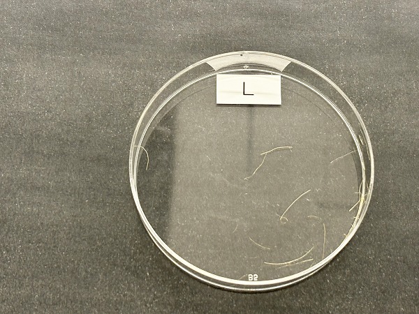 これは何だろう？みんなで異物を見つめる授業